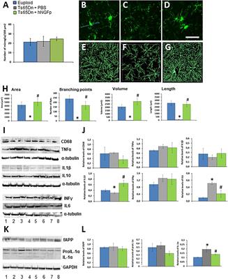 Getting Into the Brain: The Intranasal Approach to Enhance the Delivery of Nerve Growth Factor and Its Painless Derivative in Alzheimer’s Disease and Down Syndrome